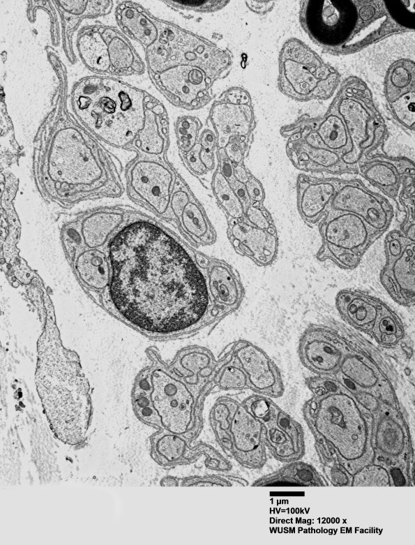 6B6 (Case 6) EM 017 - Copy