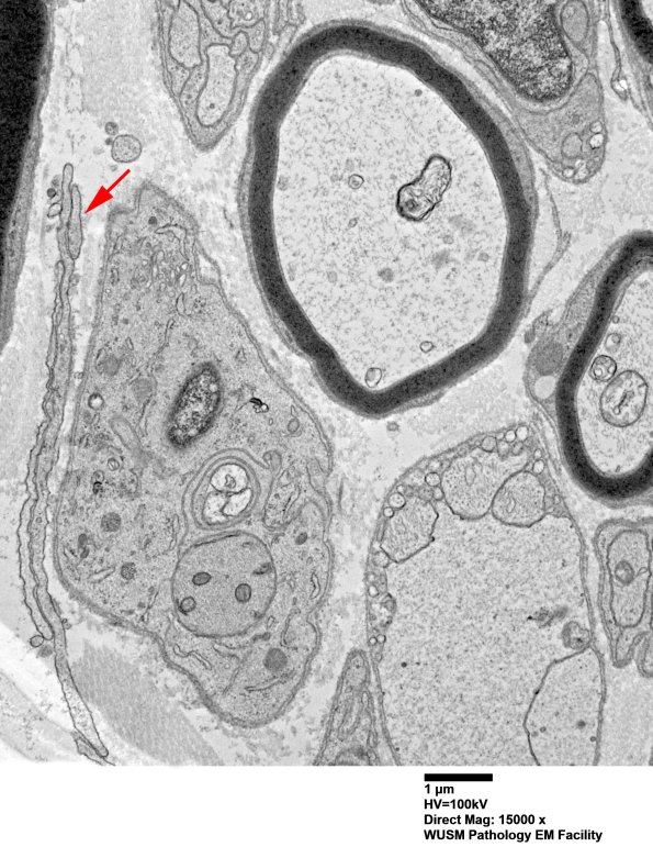 6B7 (Case 6) EM 013 - Copy copy