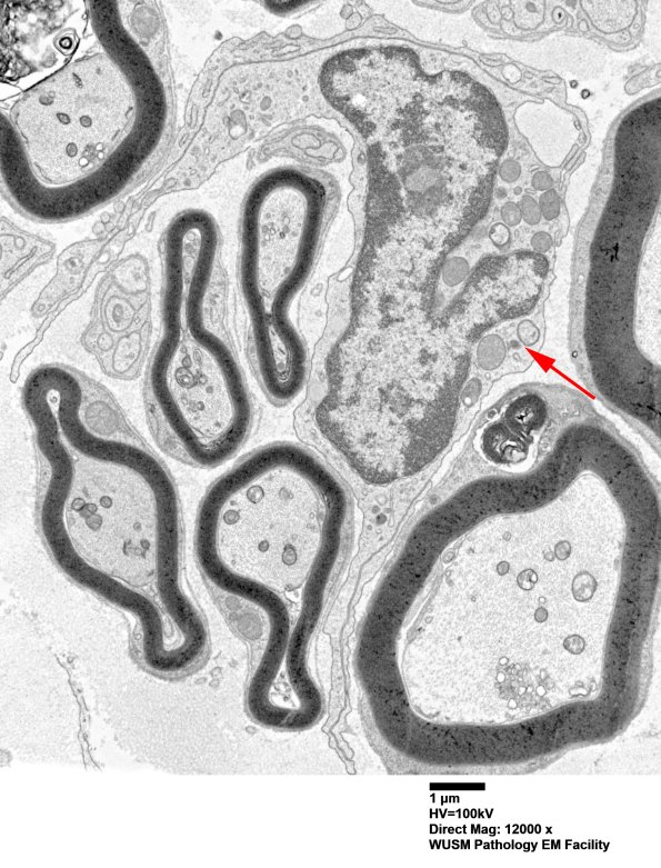 6B8 (Case 6) EM 016 - Copy copy