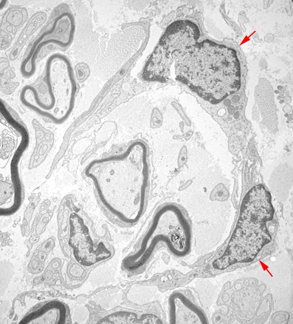 6B9 (Case 6) EM 037 - Copy copy