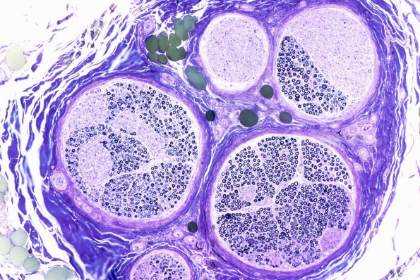 1A0 normal Cervical Vagus nerve Plastic 1