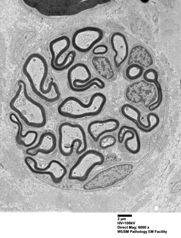 1B1 (Case 1) EM 015 - Copy