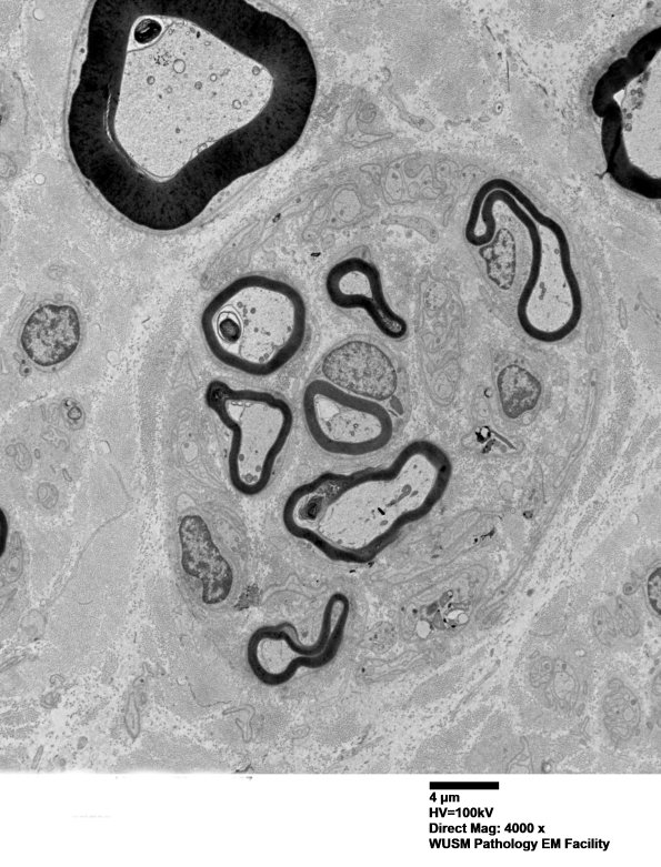 1B11 (Case 1) EM 037 - Copy