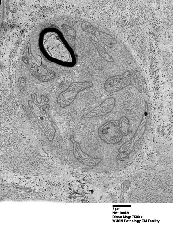 1B12 (Case 1) EM 081 - Copy