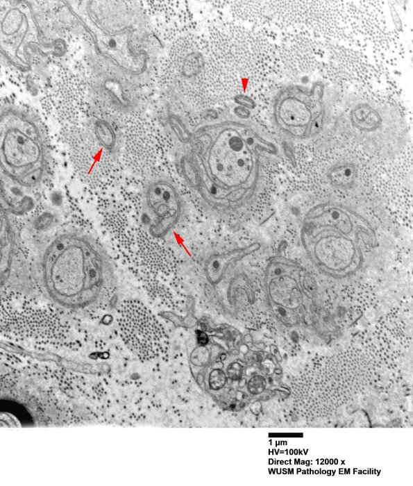1B13 (Case 1) EM 065 copy - Copy
