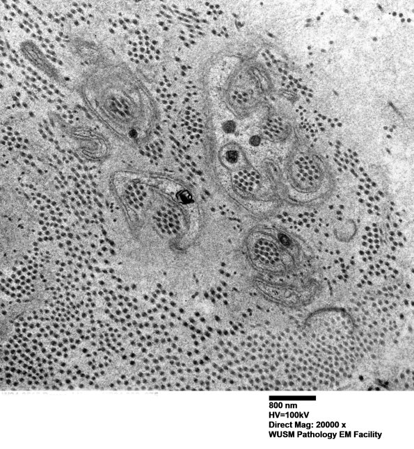 1B14 (Case 1) EM 075 - Copy - Copy