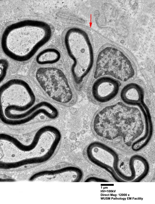 1B2 (Case 1) EM 011 copy - Copy