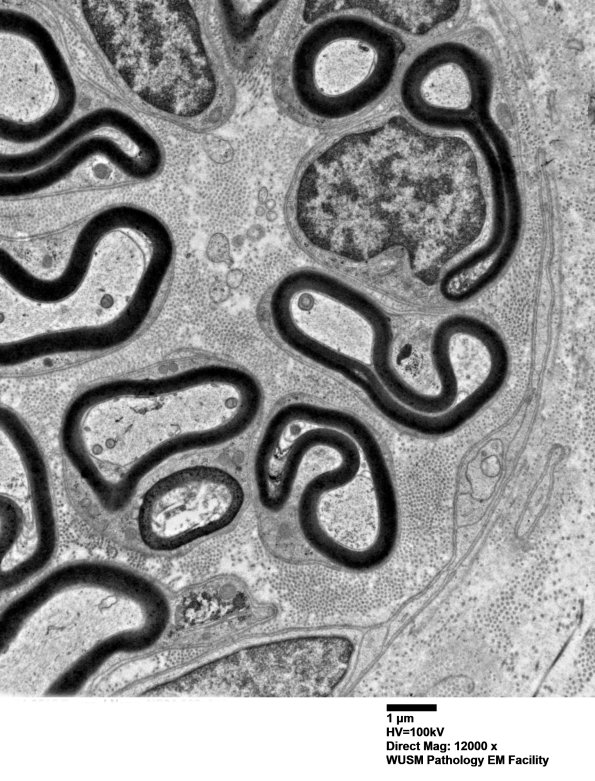 1B3 (Case 1) EM 012 - Copy