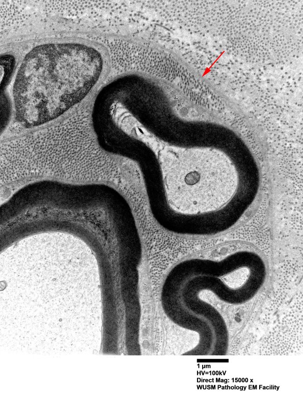 1B5 (Case 1) EM 024 copy - Copy