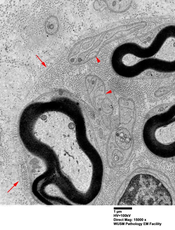 1B7 (Case 1) EM 032 copy copy - Copy