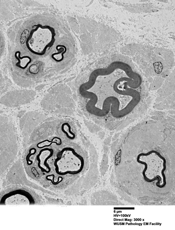 1B8 (Case 1) EM 054 - Copy