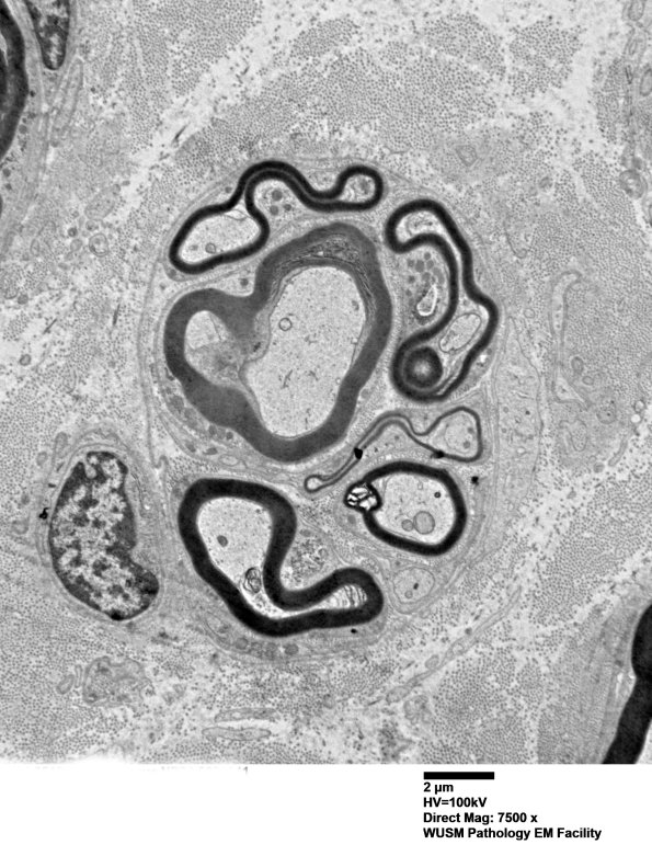 1B9 (Case 1) EM 041 - Copy