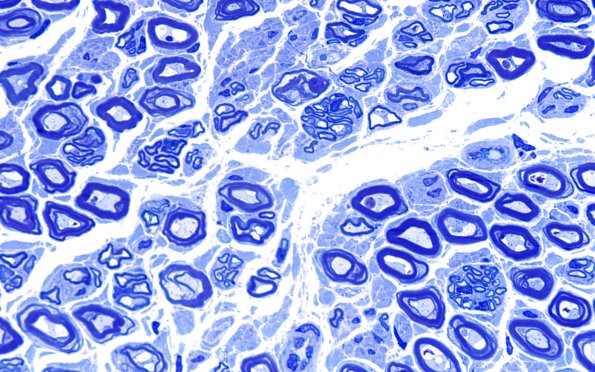 2A4 (Case 2) Plastic 100X 2