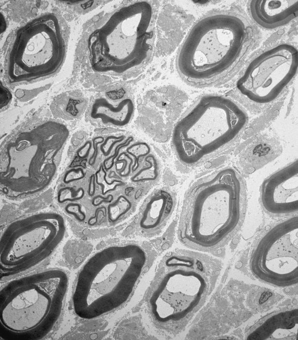 2B1 (Case 2) EM 022 - Copy