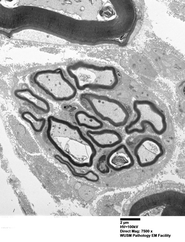 2B2 (Case 1) EM 007 - Copy