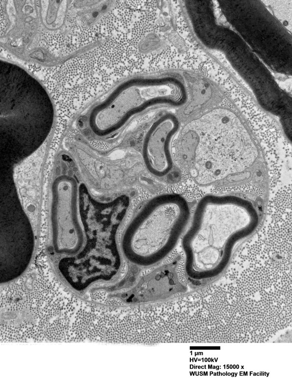 2B3 (Case 2) EM 020 - Copy