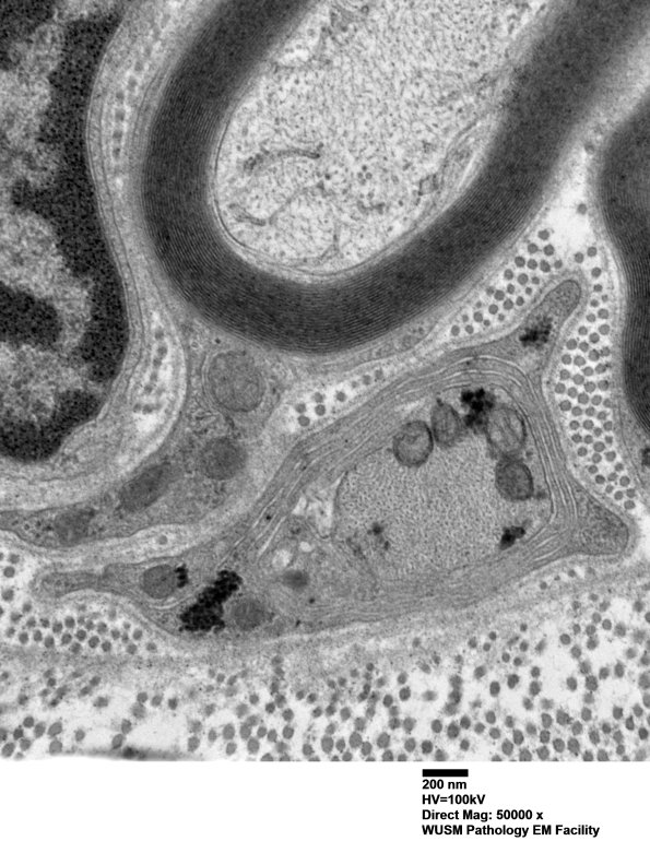 2B5 AIN_016 - Copy.jpg