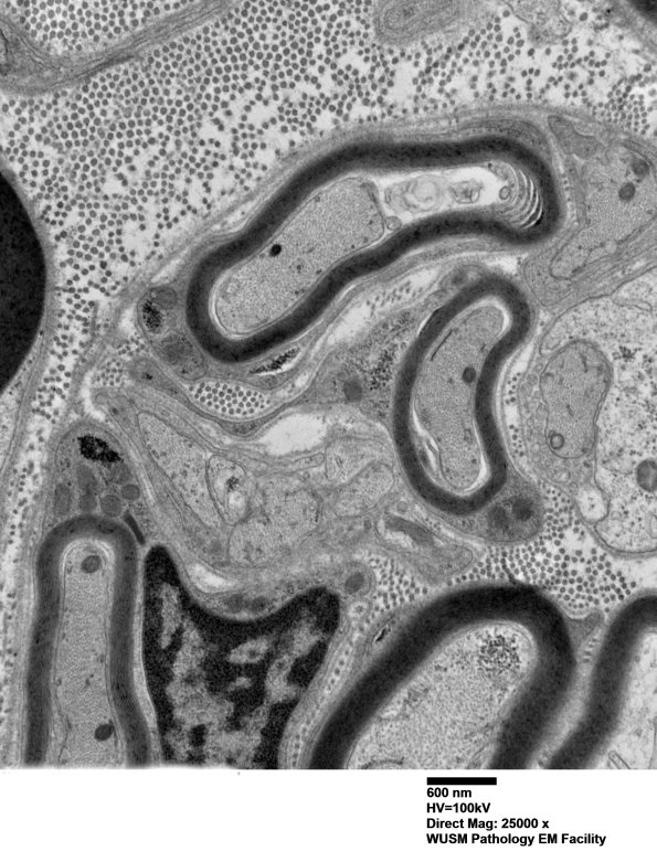 2B5 AIN_014 - Copy - Copy