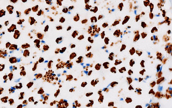 2D2 (Case 2) NF100X 1