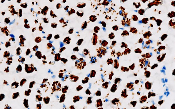 2D3 (Case 2) NF 100X 2