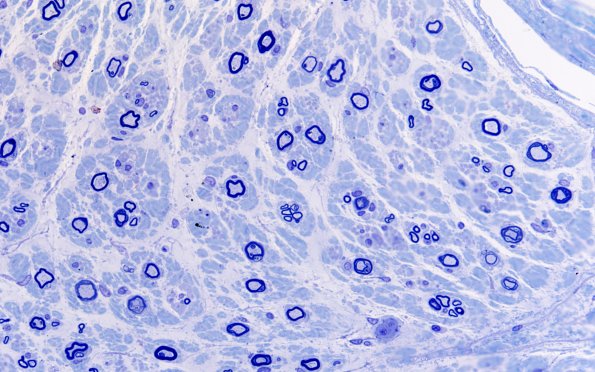 3A3 (Case 3) AIN 60X 2