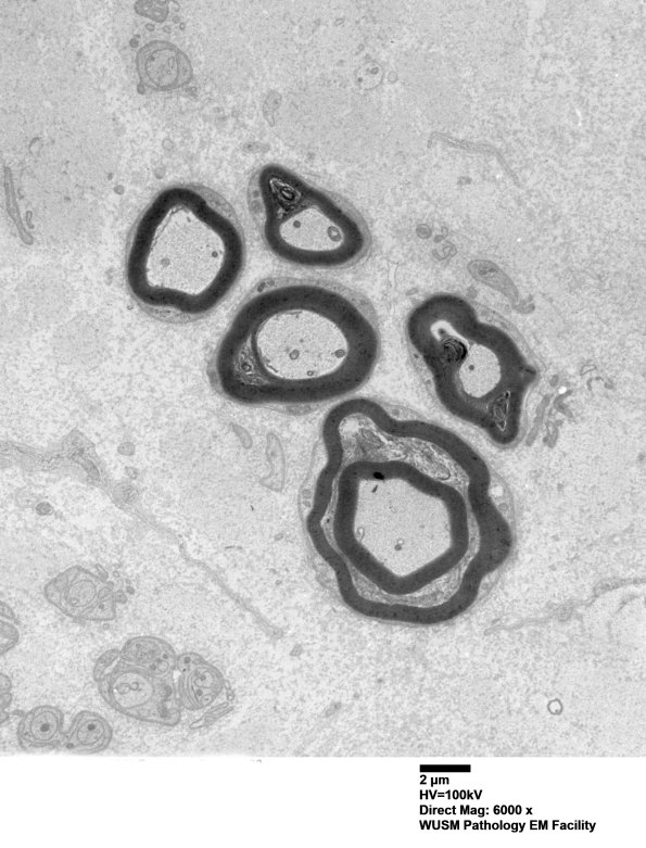 3B4 (Case 3 ) AIN EM 023 - Copy