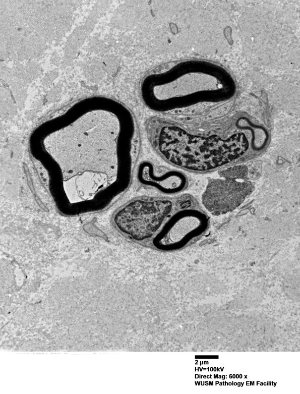 3B5 (Case 3) EM 014 - Copy