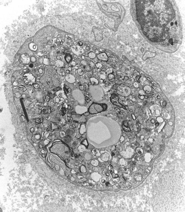 4B2 (Case 4) AIN EM 047 - Copy