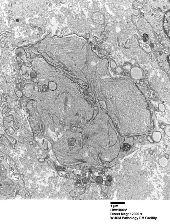 4B3 (Case 4) AIN EM 040 - Copy