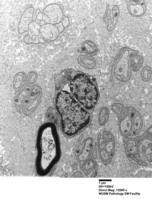 4B5 (Case 4) AIN EM 015 - Copy