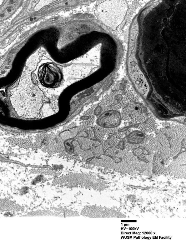 6B2 (Case 6) LABC EM 016 - Copy