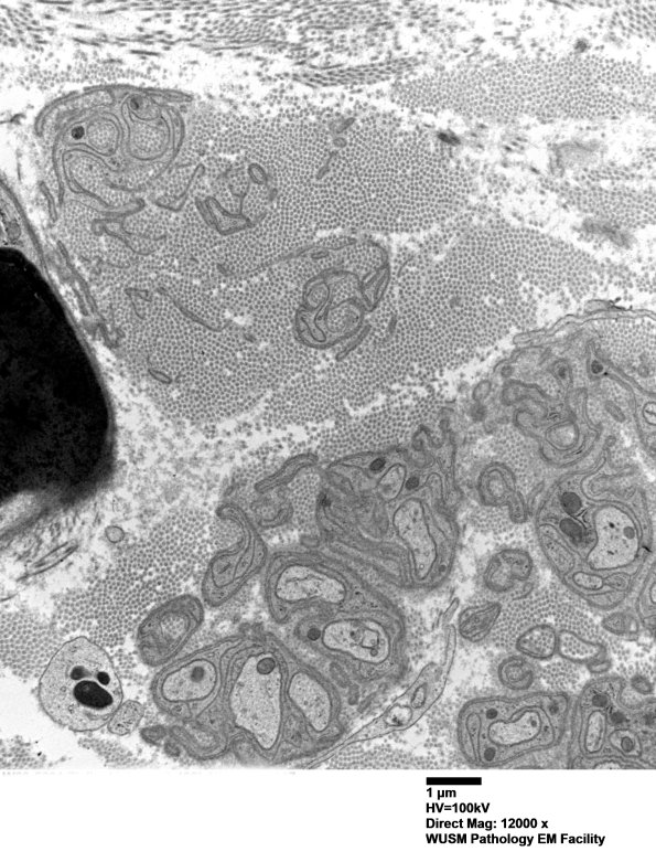 6B3 (Case 6) LABC EM 017 - Copy