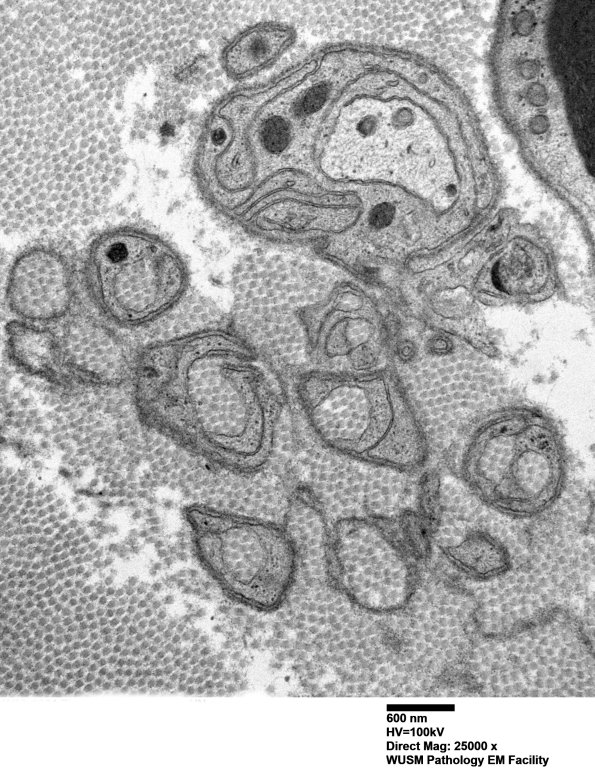 6B4 (Case 6) LABC EM 019 - Copy