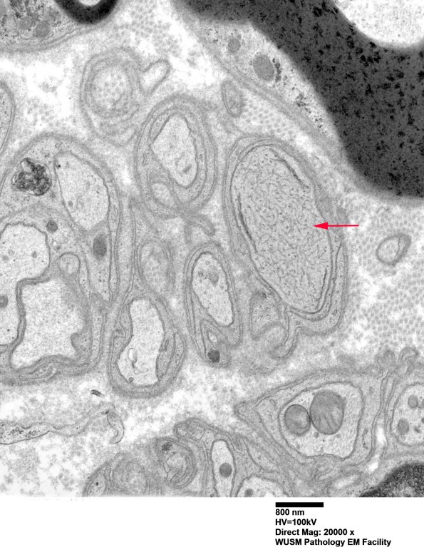 6B5 (Case 6) LABC EM 011 copy - Copy - Copy