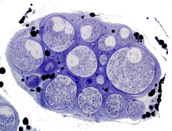 12A1 Renaut bodies (Case 12) Plastic 6.jpg