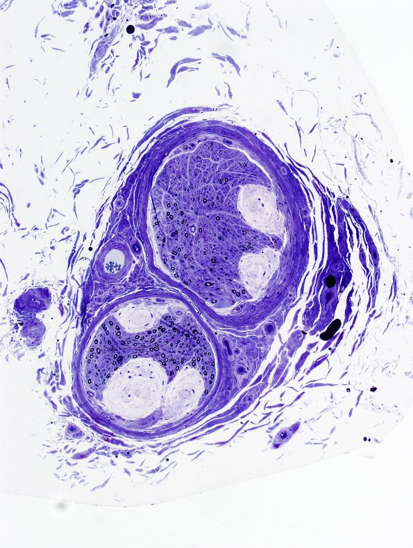 12D1 Renaut body (Case 15) Plastic 3 - Copy