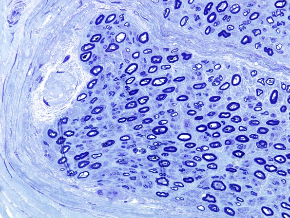 1A1 Renaut Bodies (Case 1) Plastic 3.jpg