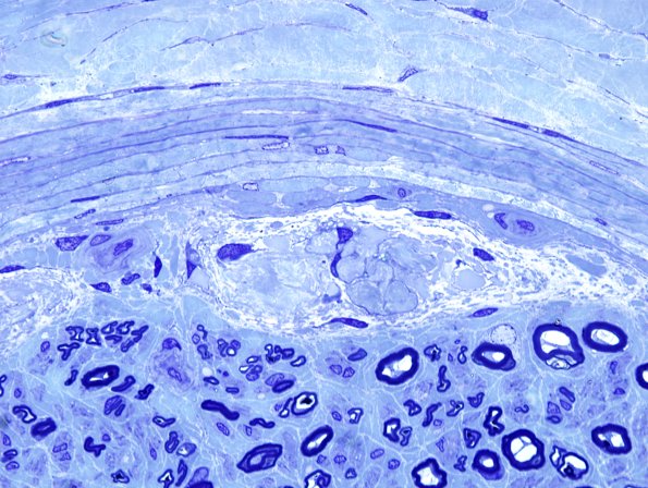 1A2 Renaut Bodies (Case 1) Plastic 7.jpg