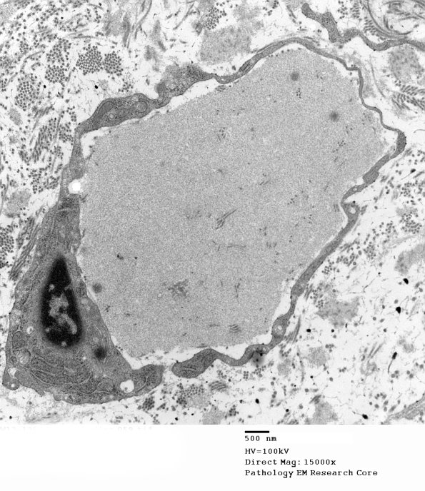 1B15 (Case 1) Renaut bodies_059 - Copy