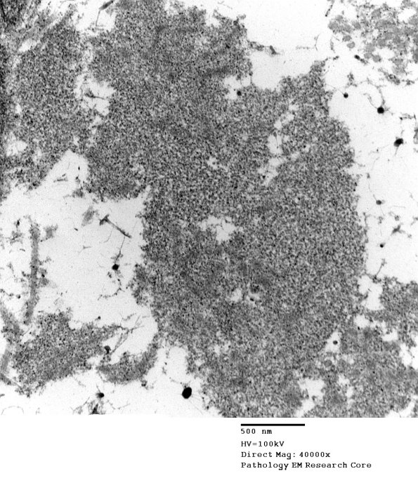 1B5 Renaut bodies (Case 1) EM 033A - Copy
