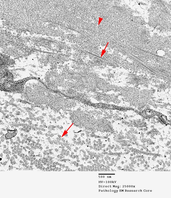 1B6 (Case 1) Mize_020 copy - Copy