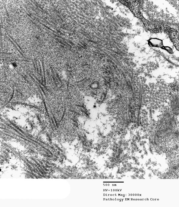 1B8 Renaut bodies (Case 1) EM 029A - Copy