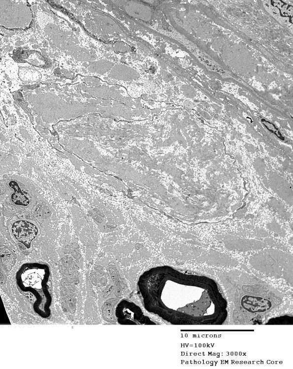 1B9 (Case 1) Mize_017 - Copy