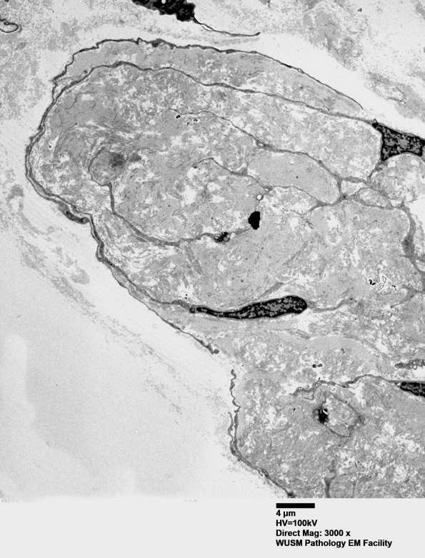 2H10 (⁮Case 2) nerve_038 - Copya