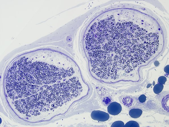 4A1 Renaut body (Case 4) Plastic 4