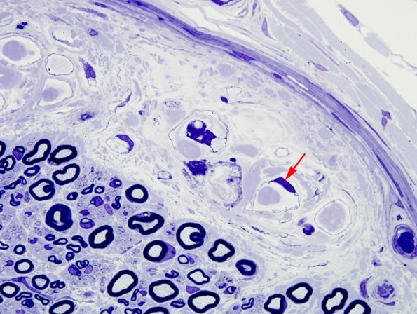 4A2 Renaut body (Case 4) Plastic 1 copy