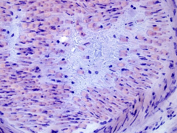 5C3 Renaut body-oma (Case 5) Congo Red 3.jpg