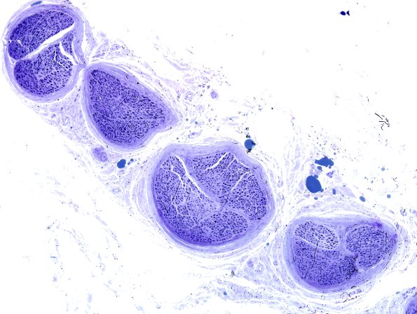 5F1 Renaut body-oma (Case 5) Block C 3.jpg