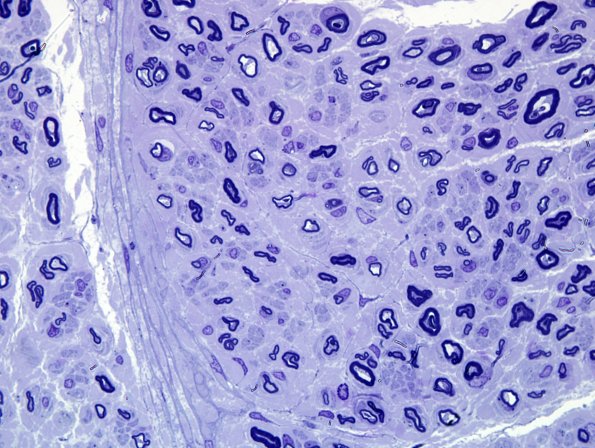 5F2 Renaut body-oma (Case 5) Block C 5.jpg