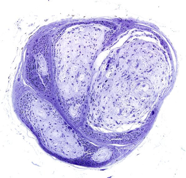 5F3 Renaut body-oma (Case 5) Plastic 12.jpg